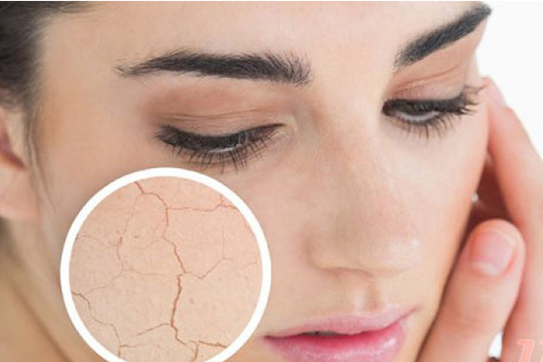 Mùa thu đông, làn da khô nứt nẻ cũng về, phải chăm sóc da như nào cho đúng?