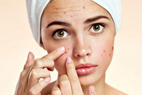 Vì sao da mụn cần dùng kem lót