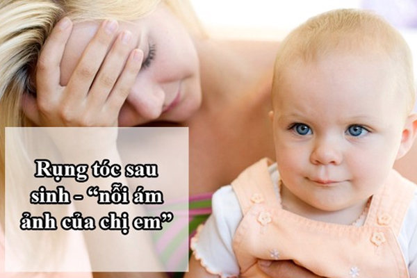 Bạn có thật sự hiểu về tình trạng rụng tóc sau khi sinh?