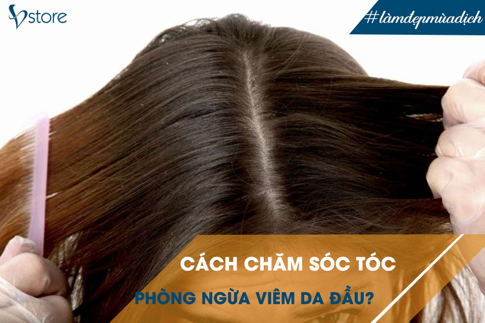 Viêm da đầu vì chăm sóc không đúng cách? Bạn cần bỏ túi 7 ghi chú này!