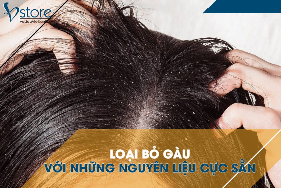 Loại bỏ gàu với những nguyên liệu cực sẵn trong căn bếp nhà bạn